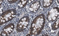 Anti-FBXO38 Antibody, clone 1I18 ZooMAb� Rabbit Monoclonal 
