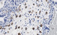Anti-FCGR2B/CD32 Antibody, clone 3G17 ZooMAb� Rabbit Monoclonal 