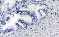 Anti-FGF-2/basic FGF Antibody, clone 1K19 ZooMAb® Rabbit Monoclonal