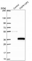 Anti-FGFR1OP2 antibody produced in rabbit 