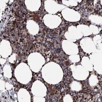 Anti-FGFR1OP2 antibody produced in rabbit 