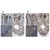 Anti-FHIT antibody produced in rabbit HPA018840-100UL