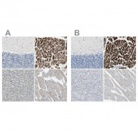 Anti-FHL2 antibody produced in rabbit 