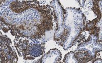 Anti-Fibrillin-1 Antibody, clone 6C19 ZooMAb� Rabbit Monoclonal 