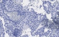 Anti-Fibrillin-1 Antibody, clone 6C19 ZooMAb� Rabbit Monoclonal 