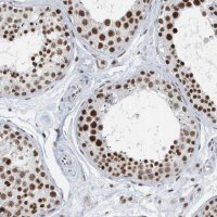 Anti-FIP1L1 antibody produced in rabbit 