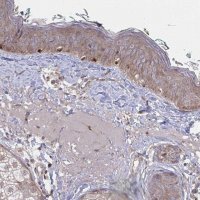 Anti-FJX1 antibody produced in rabbit 