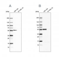 Anti-FKBP5 antibody produced in rabbit HPA031092-100UL