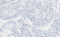 Anti-FKBP52 Antibody, clone 4H21 ZooMAb� Rabbit Monoclonal 