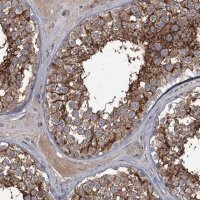 Anti-FLVCR2 antibody produced in rabbit 