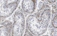 Anti-FMR1 (C-terminal) Antibody, clone 2B16 ZooMAb� Rabbit Monoclonal 