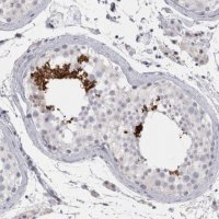 Anti-FNDC8 antibody produced in rabbit 