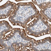 Anti-FNDC9 antibody produced in rabbit
