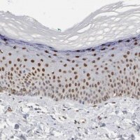 Anti-FOSL2 antibody produced in rabbit 