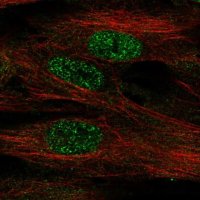 Anti-FOXF1 antibody produced in rabbit HPA028886-100UL