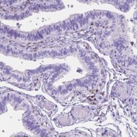 Anti-FOXL2 antibody produced in rabbit 