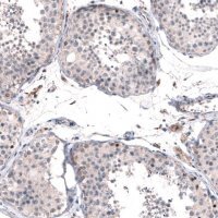 Anti-FOXM1 antibody produced in rabbit 