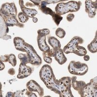 Anti-FOXO1 antibody produced in rabbit 