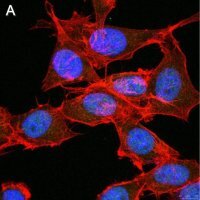 Anti-FoxP3 Antibody, clone 4J2 ZooMAb� Rabbit Monoclonal 