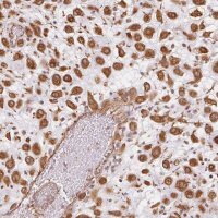 Anti-FOXR2 antibody produced in rabbit 