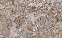 Anti-FTO Antibody, clone 4B21 ZooMAb� Rabbit Monoclonal 