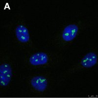 Anti-FTSJ3 Antibody, clone 3F4 ZooMAb� Rabbit Monoclonal 