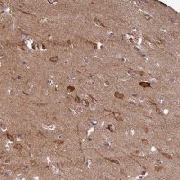 Anti-FUNDC1 antibody produced in rabbit 