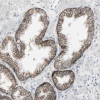 Anti-FXYD3 antibody produced in rabbit