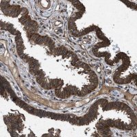 Anti-FZD6 antibody produced in rabbit