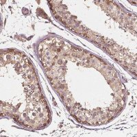 Anti-G3BP1 antibody produced in rabbit 