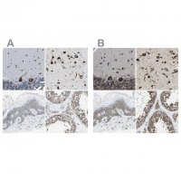 Anti-G3BP2 antibody produced in rabbit