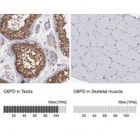 Anti-G6PD antibody produced in rabbit 