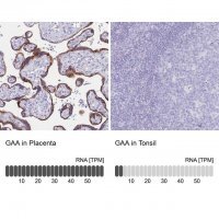 Anti-GAA antibody produced in rabbit 