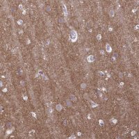 Anti-GABBR2 antibody produced in rabbit