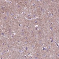 Anti-GABRB2 antibody produced in rabbit