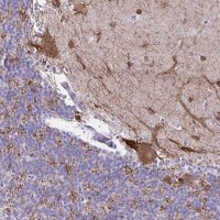 Anti-GAD1 antibody produced in rabbit HPA058412-100UL