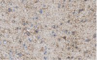 Anti-GAD67 Antibody, clone 1G10.2 ZooMAb� Mouse Monoclonal 