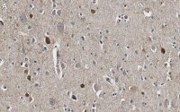 Anti-GAD67 Antibody, clone 4B5 ZooMAb� Rabbit Monoclonal 