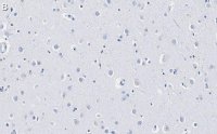 Anti-GAD67 Antibody, clone 4B5 ZooMAb� Rabbit Monoclonal 