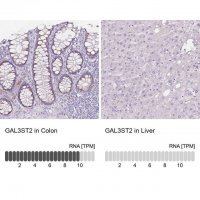 Anti-GAL3ST2 antibody produced in rabbit 