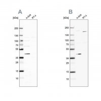 Anti-GALK1 antibody produced in rabbit
