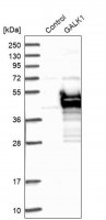 Anti-GALK1 antibody produced in rabbit
