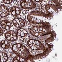 Anti-GALK2 antibody produced in rabbit HPA043564-100UL