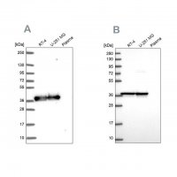 Anti-GAPDH antibody produced in rabbit HPA061280-100UL
