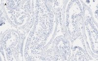 Anti-GAPDH Antibody, clone 10B13, ZooMAb® Rabbit Monoclonal