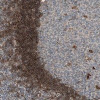 Anti-GAPT antibody produced in rabbit HPA011070-100UL