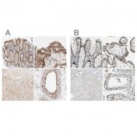 Anti-GATAD2A antibody produced in rabbit 