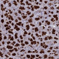 Anti-GATS antibody produced in rabbit
