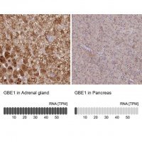 Anti-GBE1 antibody produced in rabbit HPA038073-100UL