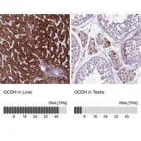 Anti-GCDH antibody produced in rabbit 